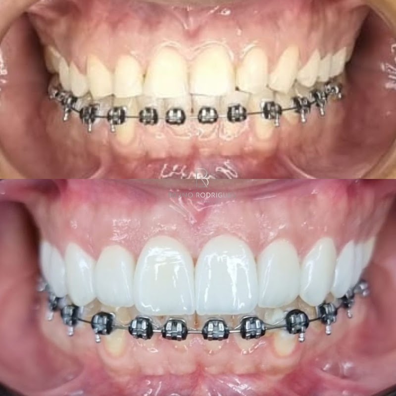 Iorb- Instituto de Odontologia Dr. Regina & Dr. Bruno